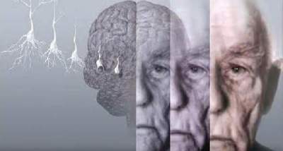 Ученые подтвердили связь между низким весом и ранними проявлениями деменции